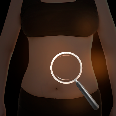 Mini Gastric Sleeve